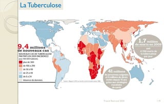 LaTuberculose
119Franck Rencurel 2020
 