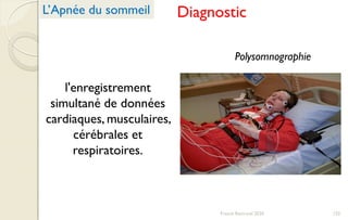 Polysomnographie
l'enregistrement
simultané de données
cardiaques, musculaires,
cérébrales et
respiratoires.
DiagnosticL’Apnée du sommeil
132Franck Rencurel 2020
 