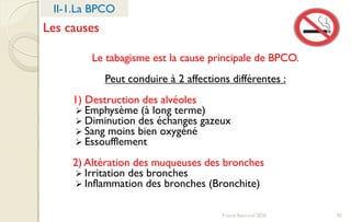 Franck Rencurel 2020 92
II-1.La BPCO
Le tabagisme est la cause principale de BPCO.
Peut conduire à 2 affections différentes :
1) Destruction des alvéoles
 Emphysème (à long terme)
 Diminution des échanges gazeux
 Sang moins bien oxygéné
 Essoufflement
2) Altération des muqueuses des bronches
 Irritation des bronches
 Inflammation des bronches (Bronchite)
Les causes
 