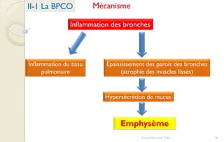 96Franck Rencurel 2020
Inflammation des bronches
Epaississement des parois des bronches
(atrophie des muscles lisses)
Hypersécrétion de mucus
Inflammation du tissu
pulmonaire
Emphysème
II-1 La BPCO Mécanisme
 