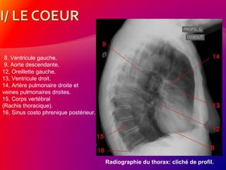 Radiographie du thorax: cliché de profil.
8, Ventricule gauche.
9, Aorte descendante.
12, Oreillette gauche.
13, Ventricule droit.
14, Artère pulmonaire droite et
veines pulmonaires droites.
15, Corps vertébral
(Rachis thoracique).
16, Sinus costo phrenique postérieur.
 