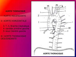 AORTE THORACIQUE
I / AORTE ASCENDANTE
II / AORTE HORIZONTALE
3- T. A. Brachio-Cèphalique
4- carotide primitive gauche
5- sous Clavière gauche
III / AORTE THORACIQUE
DESCENDANTE
AORTE THORACIQUE
 