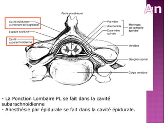 - La Ponction Lombaire PL se fait dans la cavité 
subarachnoïdienne 
- Anesthésie par épidurale se fait dans la cavité épidurale. 
 