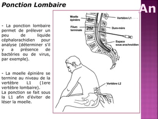 Ponction Lombaire 
- La ponction lombaire 
permet de prélever un 
peu de liquide 
céphalorachidien pour 
analyse (déterminer s'il 
y a présence de 
bactéries ou de virus, 
par exemple). 
- La moelle épinière se 
termine au niveau de la 
vertèbre L1 (1ere 
vertèbre lombaire). 
La ponction se fait sous 
la L1 afin d'éviter de 
léser la moelle. 
 
