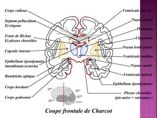 Corps calleux 
Coupe frontale de Charcot 
Septum pellucidum 
Et trigone 
Fente de Bichat 
Et plexus choroïdes 
Capsule interne 
Epithélium épendymaire 
(membrana tectoria) 
Ventricule latéral 
Nayau caudé 
Thalamus 
Claustrum 
Noyau lenticulaire 
Ventricule médian 
Noyau caudé 
Ventricule latéral 
Epithélium épendymaire 
Plexus choroïdes 
(pie-mère + vaisseaux ) 
Bandelette optique 
Corps bordant 
Corps godronné 
 