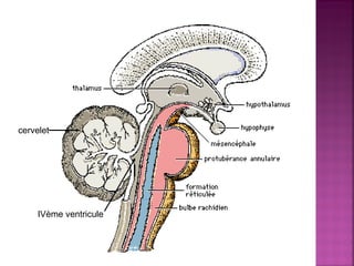 cervelet 
IVème ventricule 
 