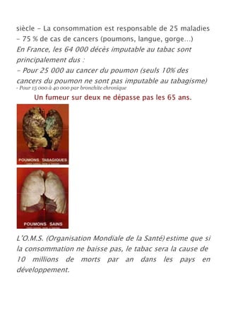 siècle - La consommation est responsable de 25 maladies
- 75 % de cas de cancers (poumons, langue, gorge…)
En France, les 64 000 décès imputable au tabac sont
principalement dus :
- Pour 25 000 au cancer du poumon (seuls 10% des
cancers du poumon ne sont pas imputable au tabagisme)
- Pour 15 000 à 40 000 par bronchite chronique
       Un fumeur sur deux ne dépasse pas les 65 ans.




L’O.M.S. (Organisation Mondiale de la Santé) estime que si
la consommation ne baisse pas, le tabac sera la cause de
10 millions de morts par an dans les pays en
développement.
 