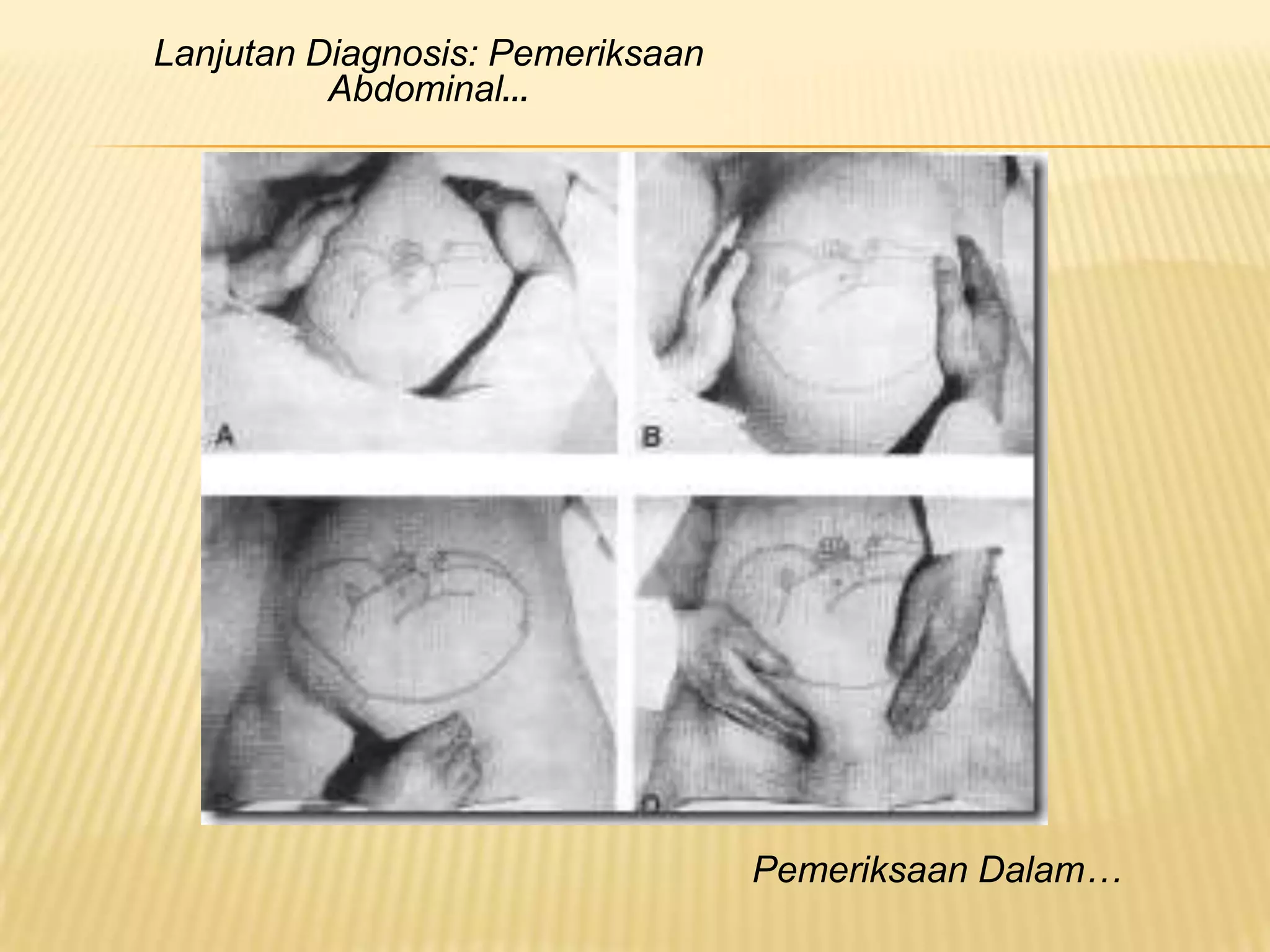 Lanjutan Diagnosis: Pemeriksaan
Abdominal…
Pemeriksaan Dalam…
 