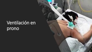 Ventilación en
prono
 