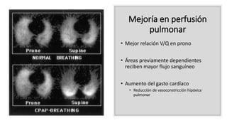 Mejoría en perfusión
pulmonar
• Mejor relación V/Q en prono
• Áreas previamente dependientes
reciben mayor flujo sanguíneo
• Aumento del gasto cardíaco
• Reducción de vasoconstricción hipóxica
pulmonar
 