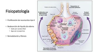 Fisiopatología
• Proliferación de neumocitos tipo II
• Reabsorción de líquido de edema
• Sodio por canalas ENaC
• Agua por acuaporinas
• Remodelación y fibrosis
 