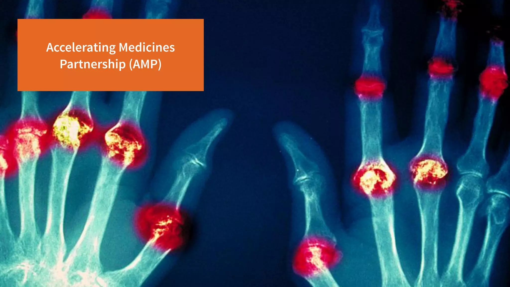 Accelerating Medicines
Partnership (AMP)
 