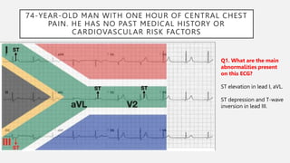 74-YEAR-OLD MAN WITH ONE HOUR OF CENTRAL CHEST
PAIN. HE HAS NO PAST MEDICAL HISTORY OR
CARDIOVASCULAR RISK FACTORS
Q1. What are the main
abnormalities present
on this ECG?
ST elevation in lead I, aVL.
ST depression and T-wave
inversion in lead III.
 