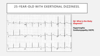 25-YEAR-OLD WITH EXERTIONAL DIZZINESS.
Q2. What is the likely
diagnosis?
Hypertrophic
Cardiomyopathy (HCM)
 