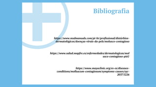 Bibliografia
https://www.msdmanuals.com/pt-br/profissional/distúrbios-
dermatológicos/doenças-virais-da-pele/molusco-contagioso
https://www.salud.mapfre.es/enfermedades/dermatologicas/mol
usco-contagioso-piel/
https://www.mayoclinic.org/es-es/diseases-
conditions/molluscum-contagiosum/symptoms-causes/syc-
20375226
 
