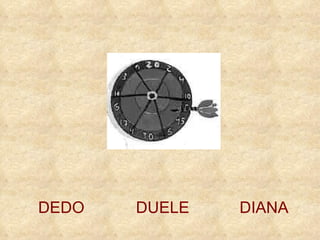 DIANA DEDO DUELE 