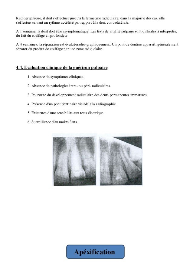 Linstruction aux comprimés tabeks
