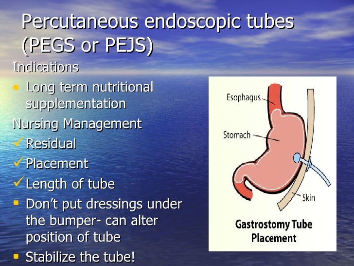 Let’S Go Tubing! Understanding Gi And Gu