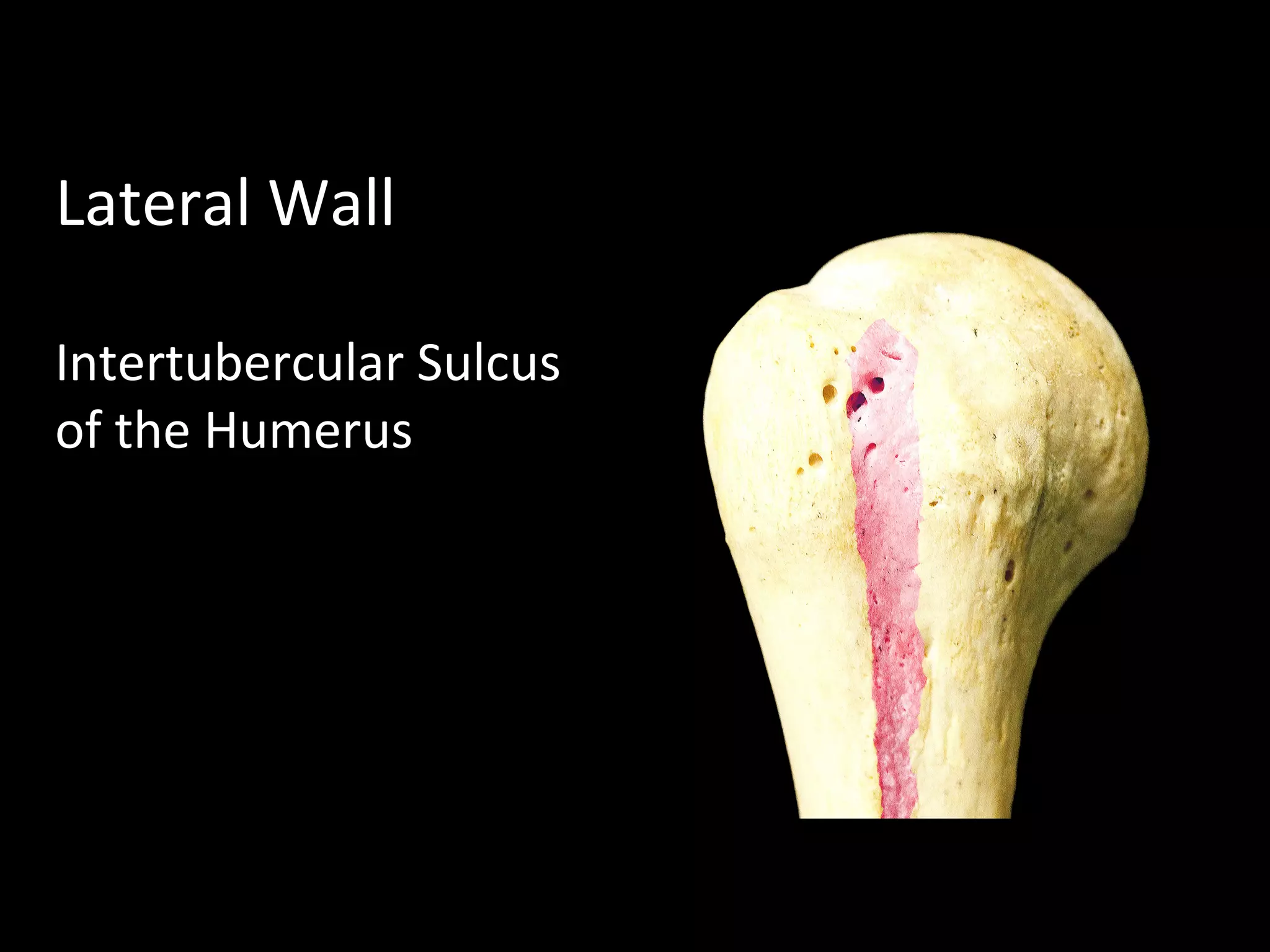 Lateral Wall
Intertubercular Sulcus
of the Humerus
 