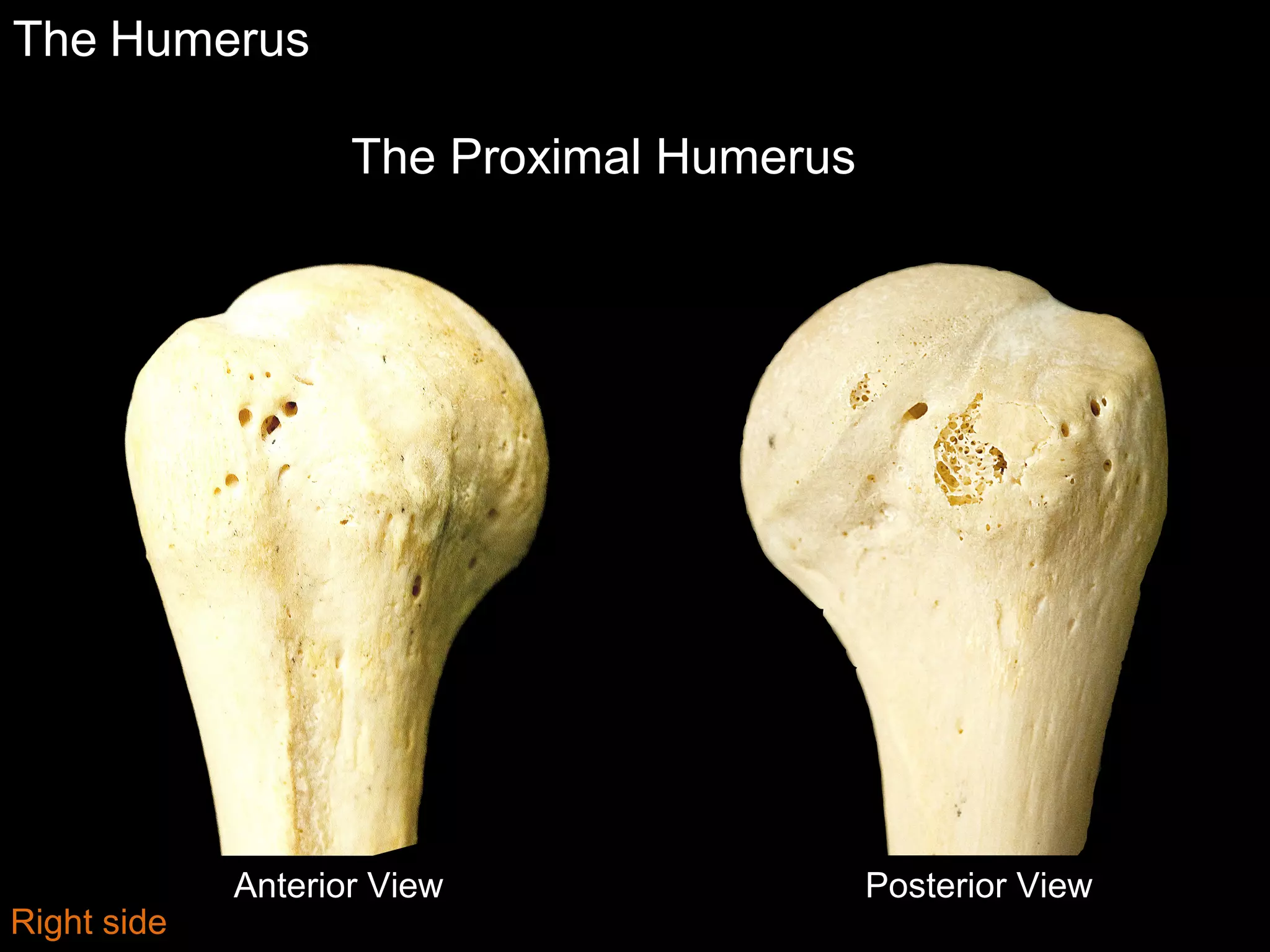 Slideshow: Humerus | PPT