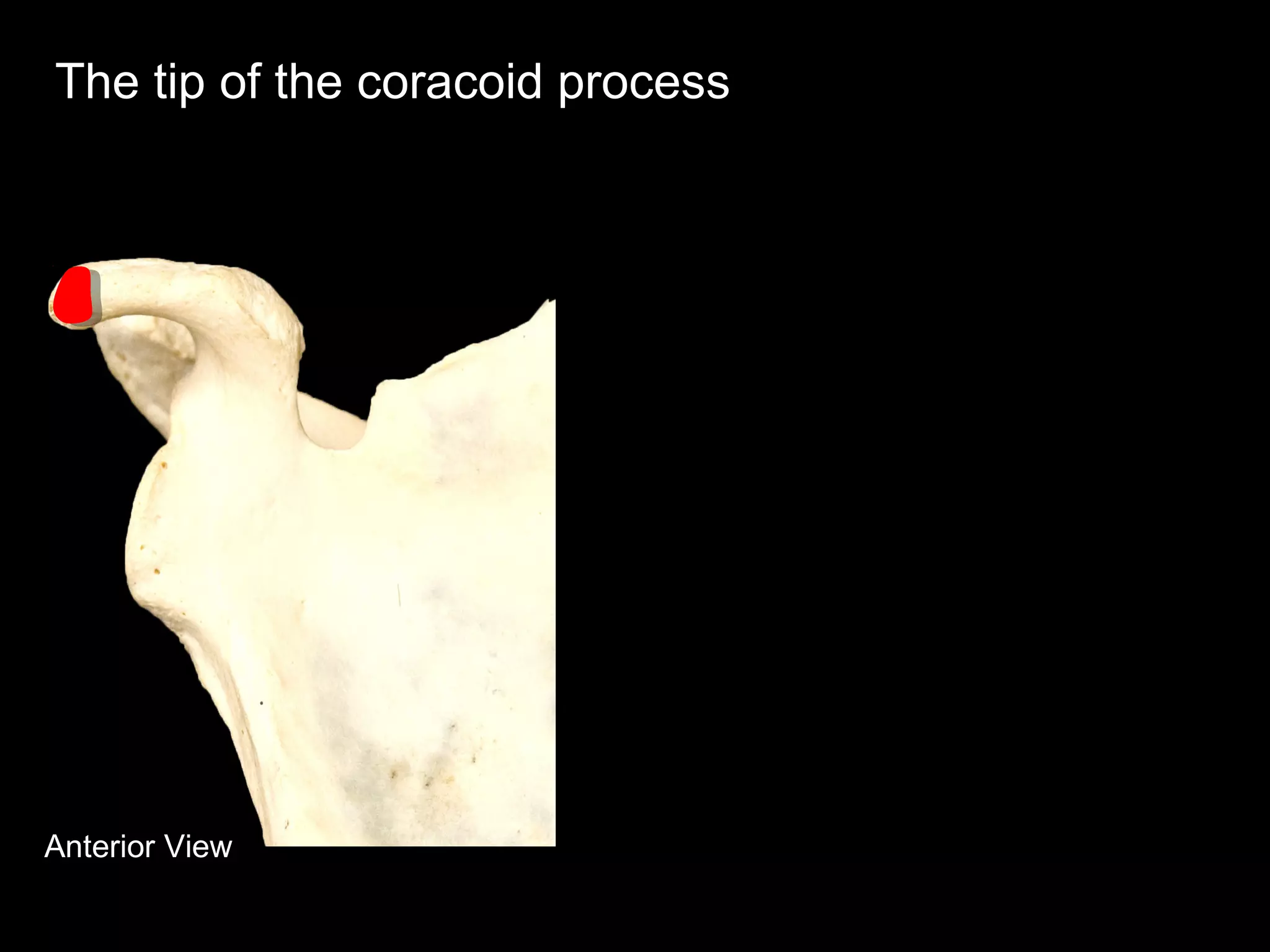 Anterior View
The tip of the coracoid process
 