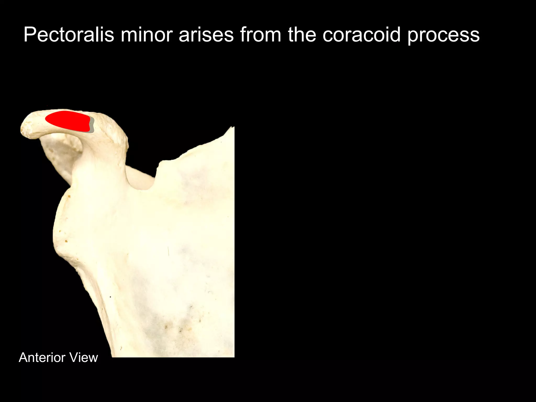 Anterior View
Pectoralis minor arises from the coracoid process
 