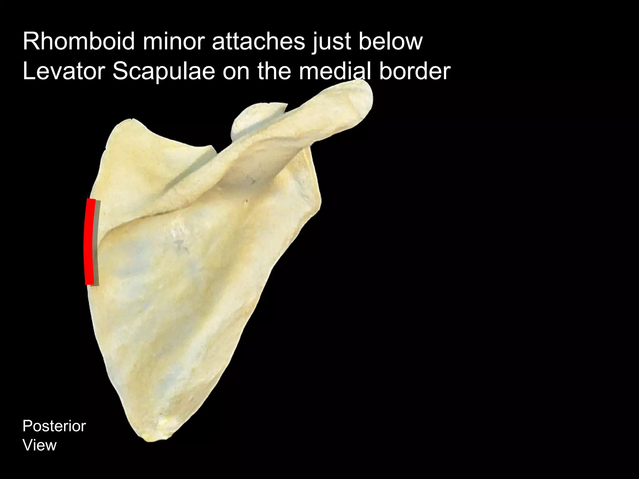 Posterior
View
Rhomboid minor attaches just below
Levator Scapulae on the medial border
 
