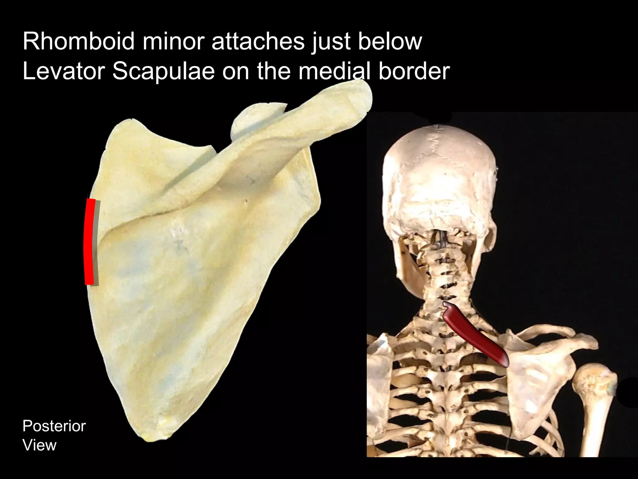Posterior
View
Rhomboid minor attaches just below
Levator Scapulae on the medial border
 