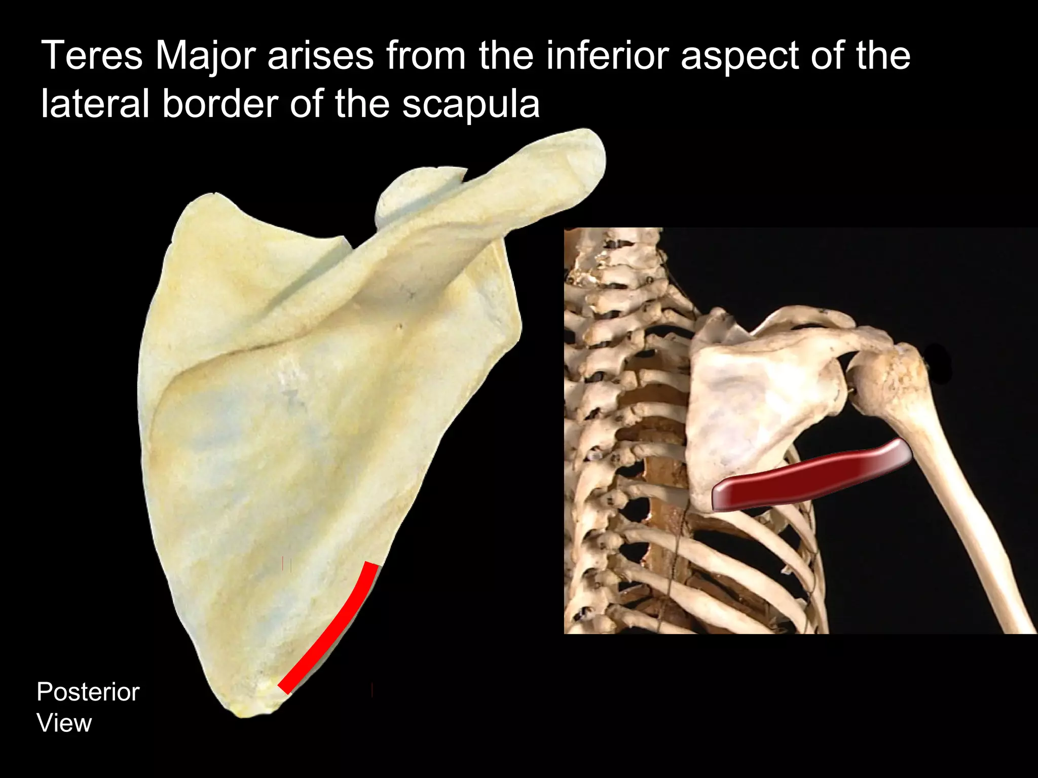 Posterior
View
Teres Major arises from the inferior aspect of the
lateral border of the scapula
 