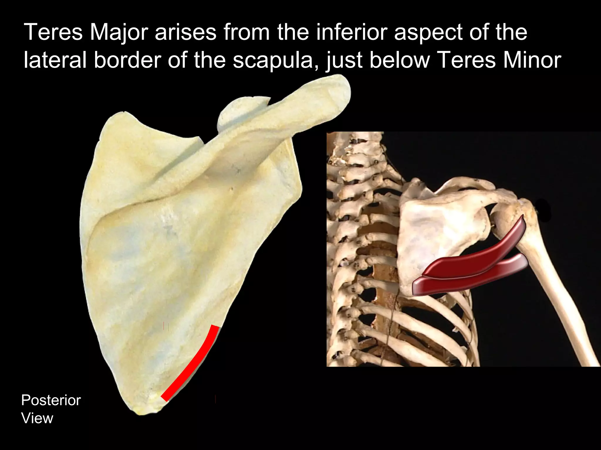 Posterior
View
Teres Major arises from the inferior aspect of the
lateral border of the scapula, just below Teres Minor
 