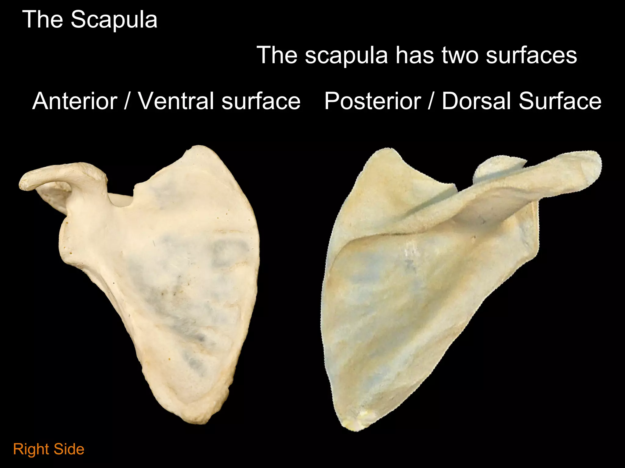 The Scapula
Anterior / Ventral surface Posterior / Dorsal Surface
The scapula has two surfaces
Right Side
 