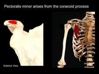 Anterior View
Pectoralis minor arises from the coracoid process
 