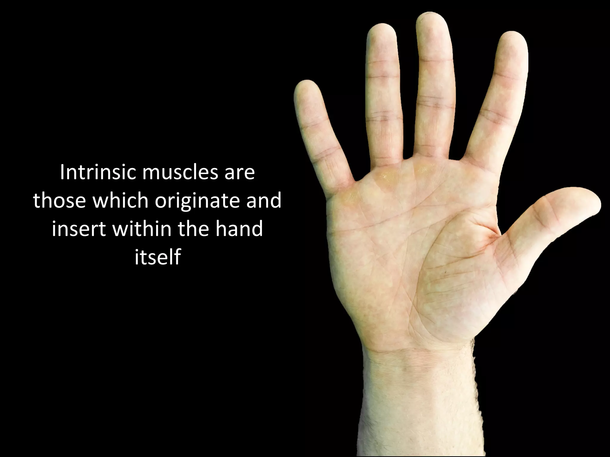 Intrinsic muscles are
those which originate and
insert within the hand
itself
 