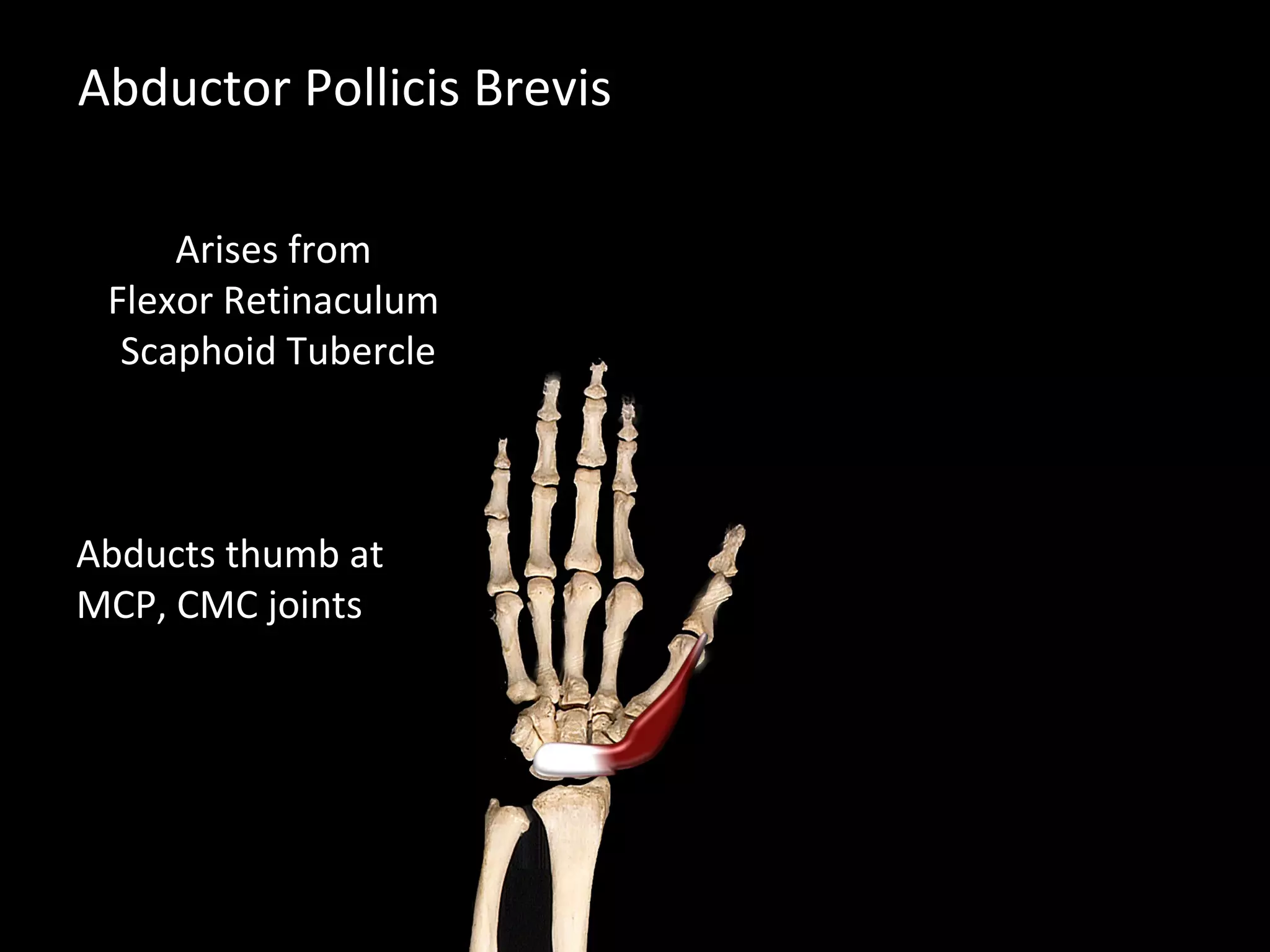 Abductor Pollicis Brevis
Abducts thumb at
MCP, CMC joints
Arises from
Flexor Retinaculum
Scaphoid Tubercle
 