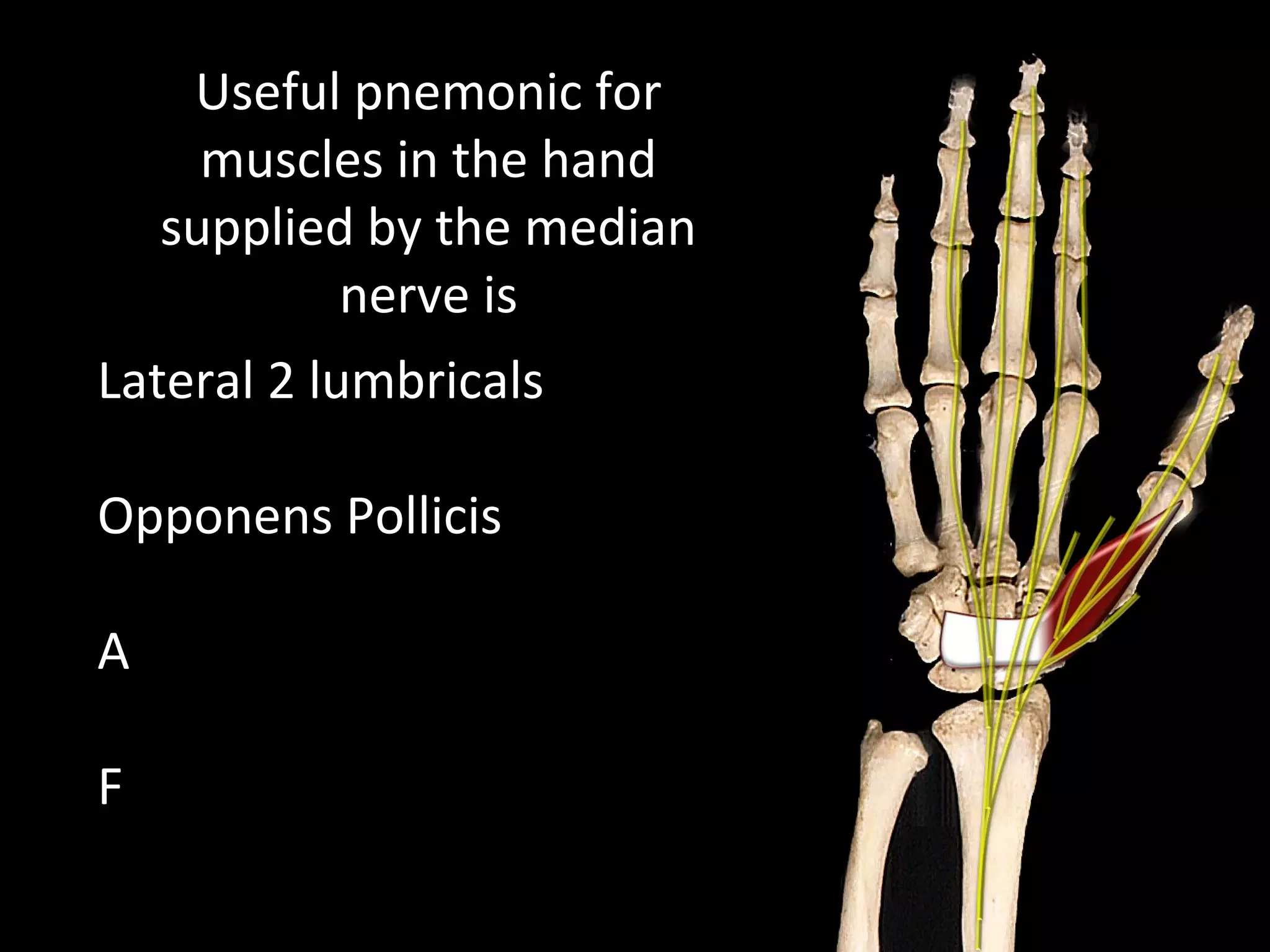 Useful pnemonic for
muscles in the hand
supplied by the median
nerve is
Lateral 2 lumbricals
Opponens Pollicis
A
F
 
