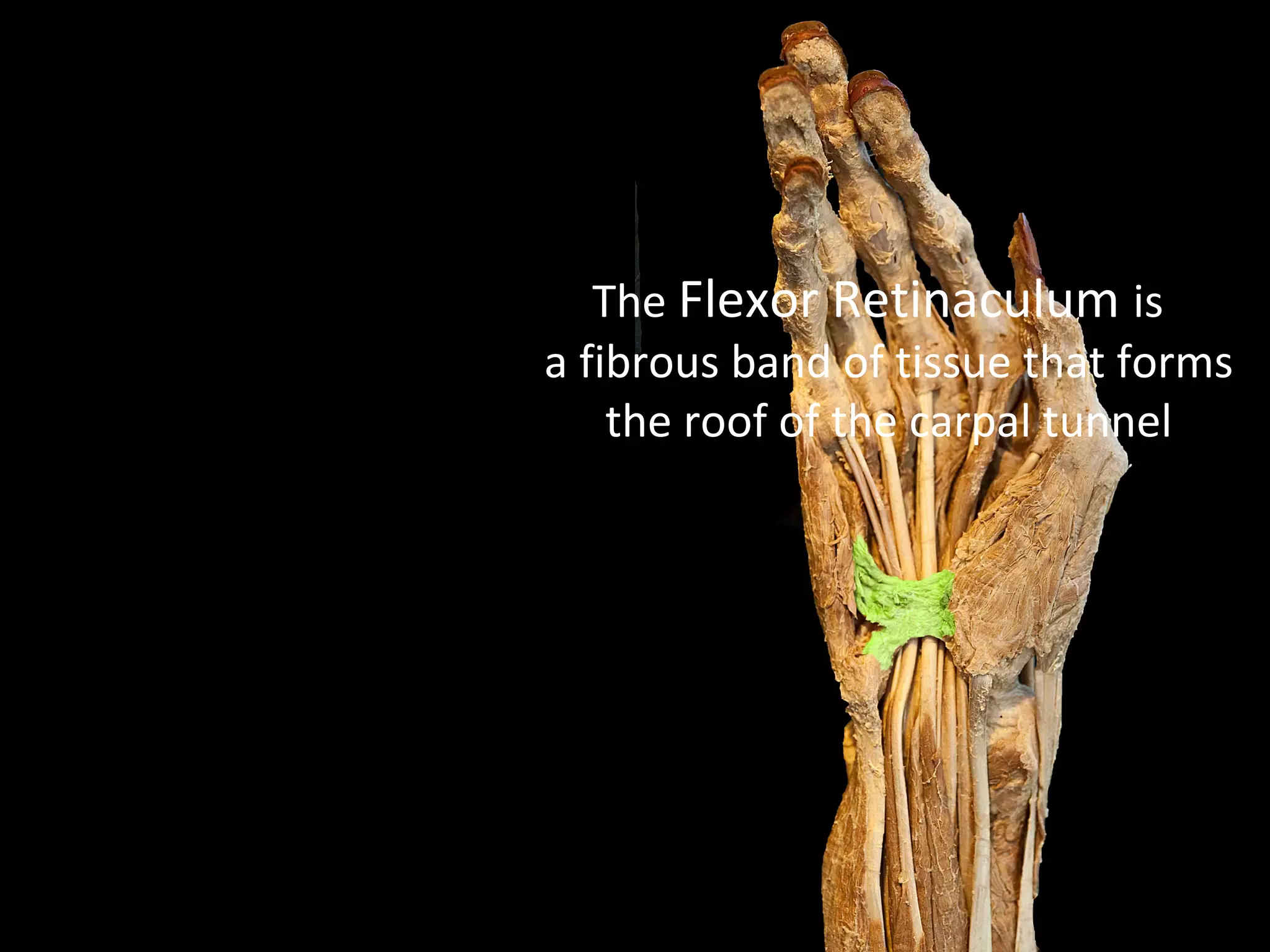 The Flexor Retinaculum is
a fibrous band of tissue that forms
the roof of the carpal tunnel
 