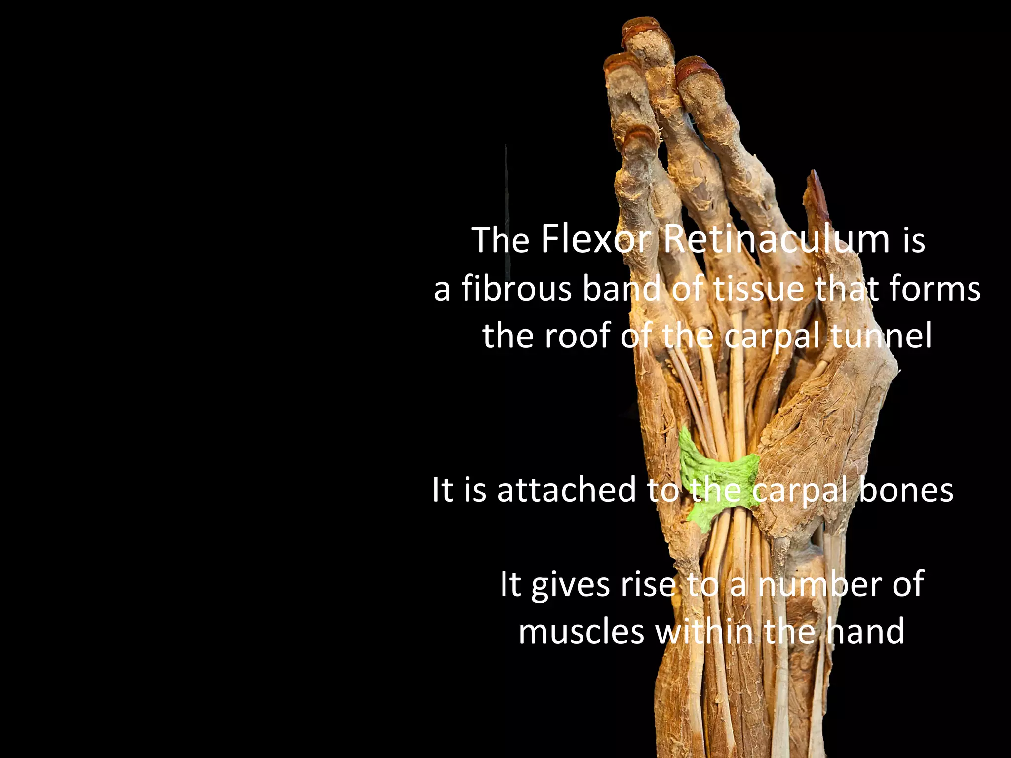 The Flexor Retinaculum is
a fibrous band of tissue that forms
the roof of the carpal tunnel
It is attached to the carpal bones
It gives rise to a number of
muscles within the hand
 