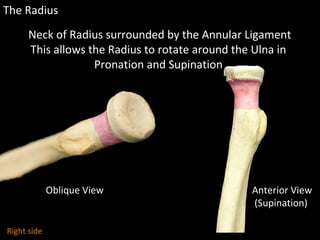 The Radius
Oblique View Anterior View
(Supination)
Neck of Radius surrounded by the Annular Ligament
This allows the Radiu...