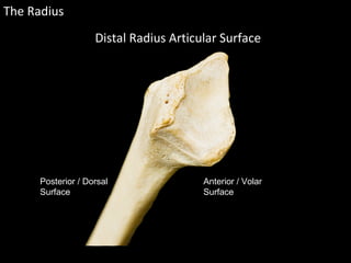 The Radius
Distal Radius Articular Surface
Posterior / Dorsal
Surface
Anterior / Volar
Surface
 