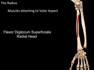 The Radius
Flexor Digitorum Superficialis
Radial Head
Muscles attaching to Volar Aspect
 