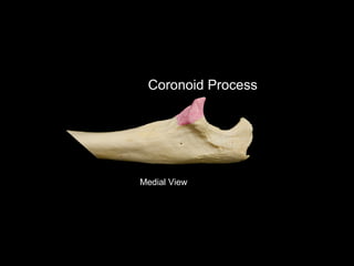 Slideshow: Ulna | PPT