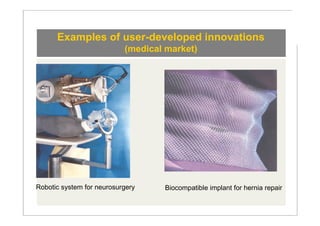 Examples of user-developed innovations
                           (medical market)




Robotic system for neurosurgery    Biocompatible implant for hernia repair
 