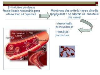 Eritrócitos perdem a
flexibilidade necessária para    Membrana dos eritrócitos se alterão
   atravessar os capilares      (pegajosas) e se aderem ao endotélio
                                              dos vasos:

                                   •Vasooclusão
                                   microvascular
                                   •Hemólise
                                   prematura
 