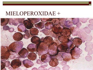 MIELOPEROXIDAE +
 