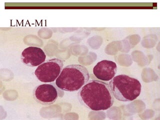 LMA-M1
 