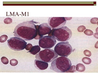 LMA-M1
 