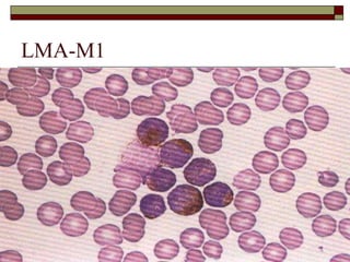 LMA-M1
 