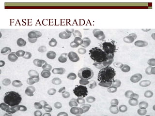 FASE ACELERADA:
 