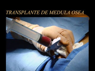 TRANSPLANTE DE MEDULA OSEA 