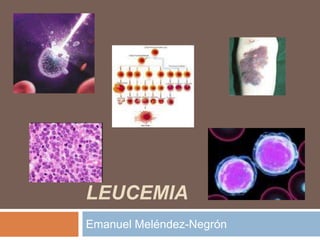 Leucemia Emanuel Meléndez-Negrón   
